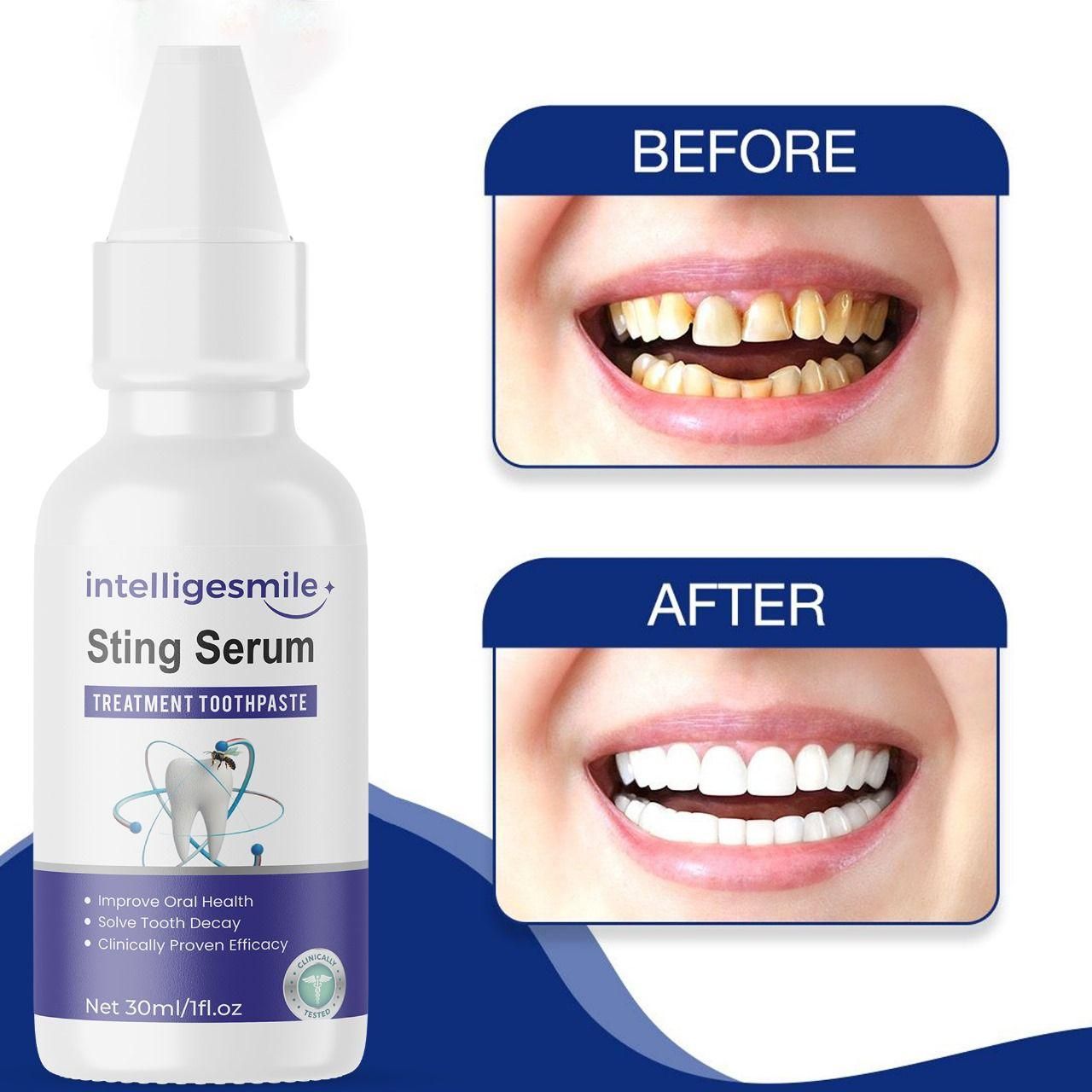 Intelligesmile Sting Serum Treatment Toothpaste 60ml Pack of 2